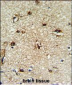 TCPR1 Antibody (N-term)